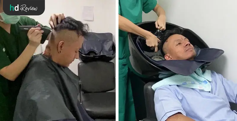 ขั้นตอนการปลูกผม ด้วยเทคนิค FUE ที่ GROW & Clinic วันที่ 2