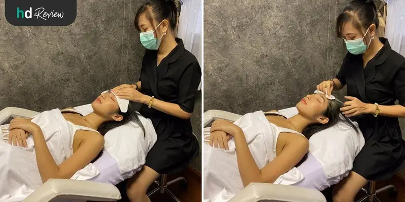ขั้นตอนการ Wax & Laser