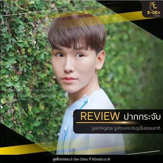 รีวิว ศัลยกรรม ปากกระจับ ที่ E-Den Clinic