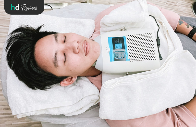 รีวิว Cryo V สลายไขมันเหนียงด้วยความเย็น ที่ Wink Clinic