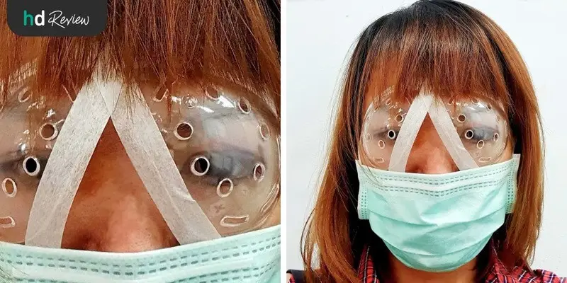 ผู้ใช้บริการทำเลสิก ที่ รพ.ยันฮี
