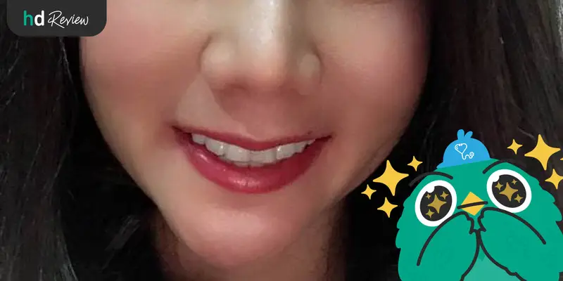 มั่นใจในรอยยิ้มใหม่ด้วยการจัดฟันแบบใสกับ Zenyum 6 ผลลัพธ์หลังจัดฟันแบบใสกับ Zenyum