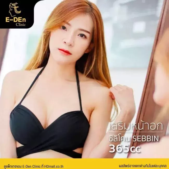 รีวิว เสริมหน้าอก ที่ E-Den Clinic