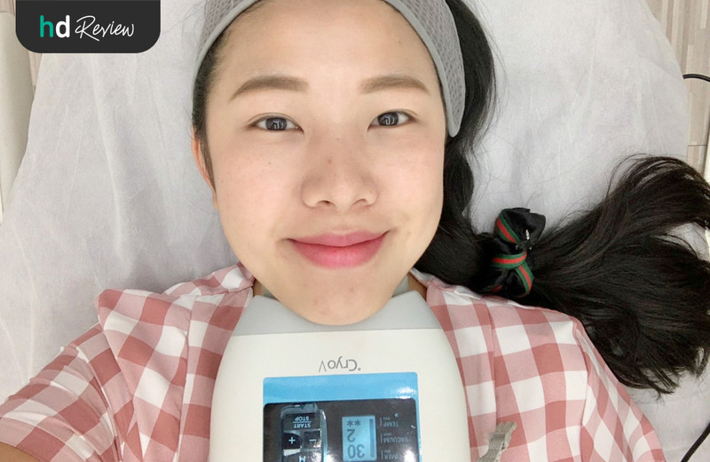 รีวิว Cryo V สลายไขมันเหนียงด้วยความเย็น ที่ Wink Clinic