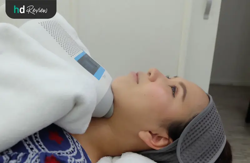 รีวิว Cryo V สลายไขมันเหนียงด้วยความเย็น ที่ Wink Clinic