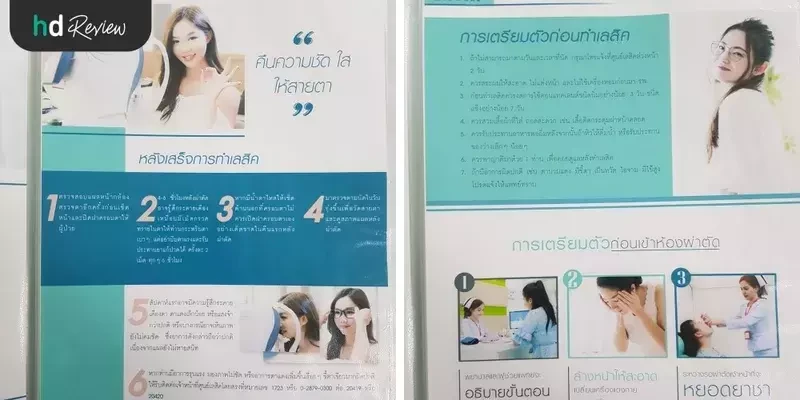รีวิว ทำเลสิก ที่ โรงพยาบาลยันฮี