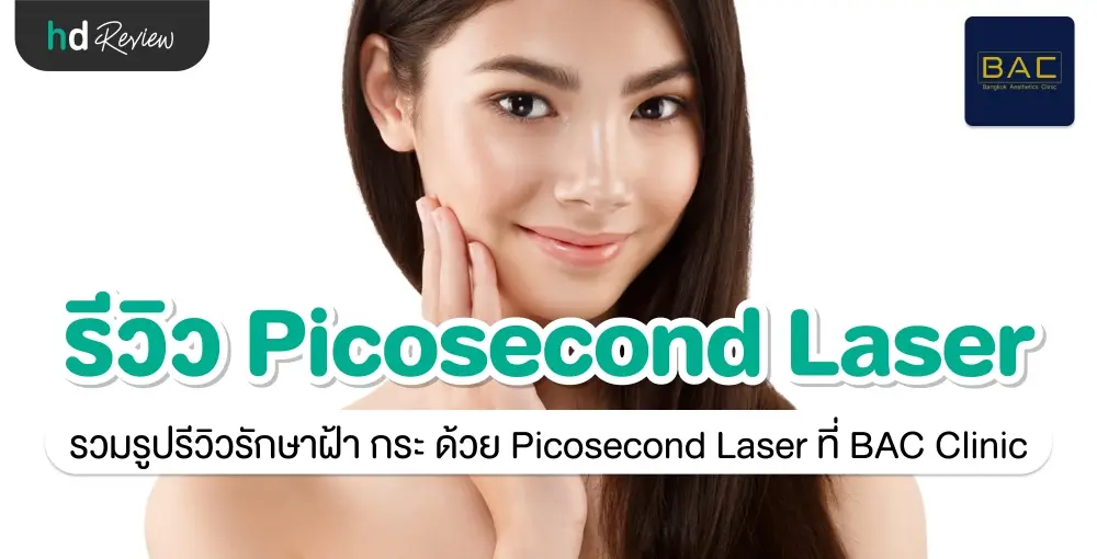 รีวิว รักษาฝ้ากระ ด้วย Picosecond ที่ BAC Clinic