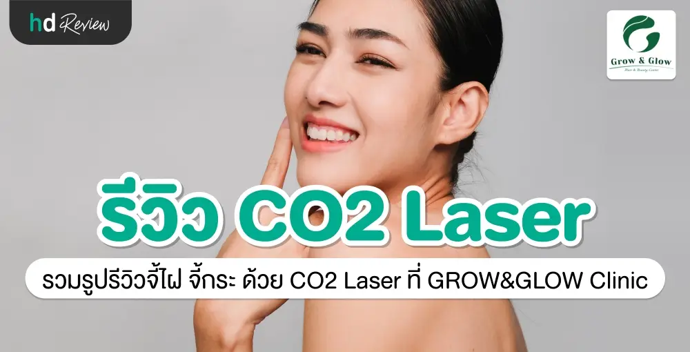 รีวิว จี้ไฝ จี้กระ ด้วย CO2 Laser ที่ GROW & GLOW Clinic