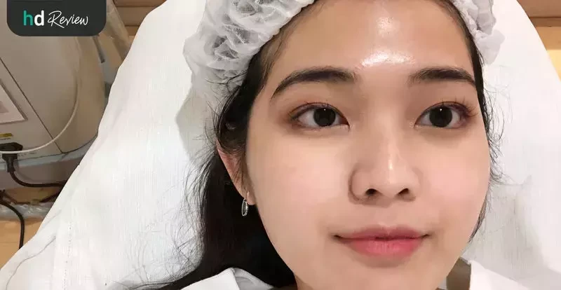 ภาพระหว่างการใช้บริการทำ Thermatite ยกกระชับใบหน้า ที่ SC Skinclub Clinic