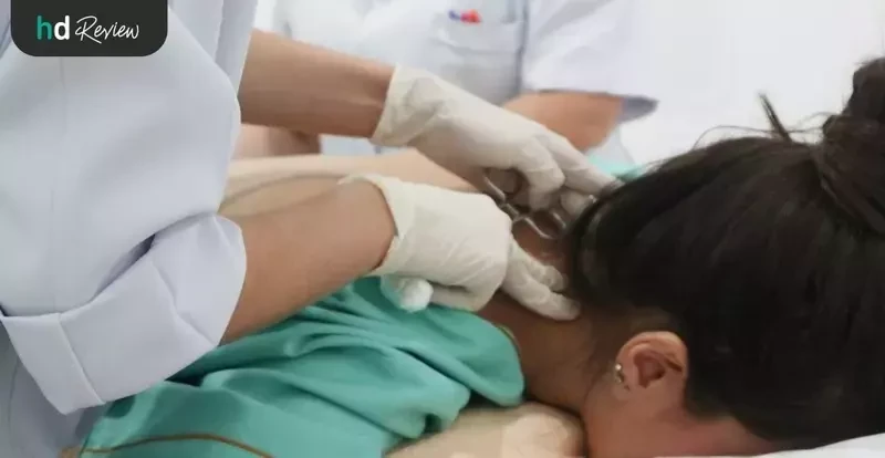 ภาพขั้นตอนการฝังเข็ม