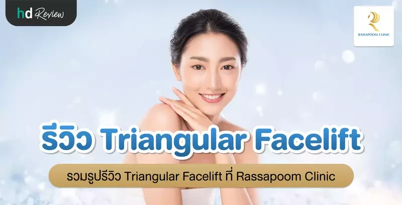 รีวิว Triangular Facelift ที่ Rassapoom Clinic (รัสมิ์ภูมิคลินิก)