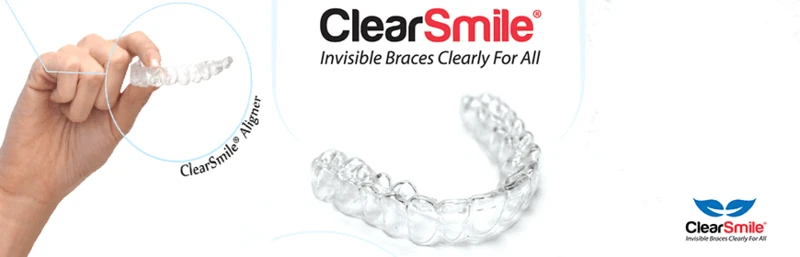 จัดฟันใส Clear Smile