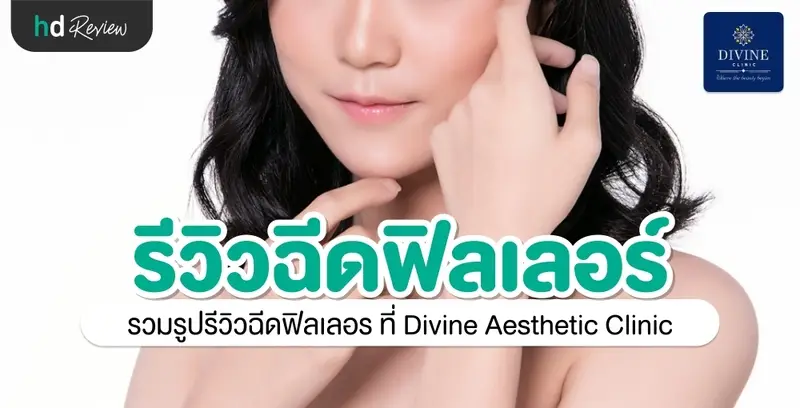 รีวิวฉีดฟิลเลอร์ ที่ Divine Aesthetic Clinic
