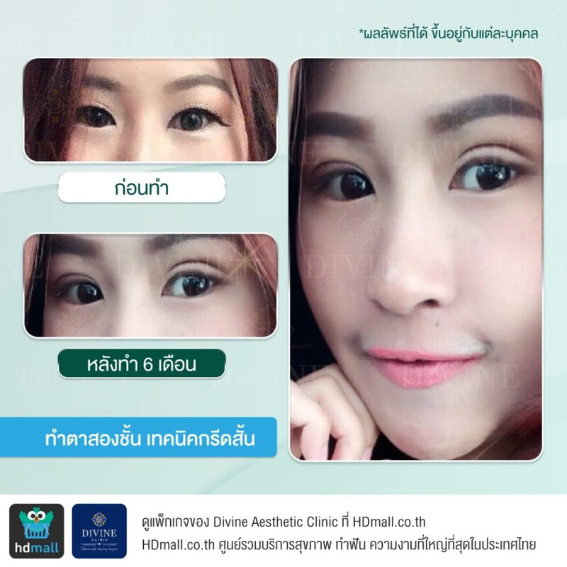 content Divine eyelid