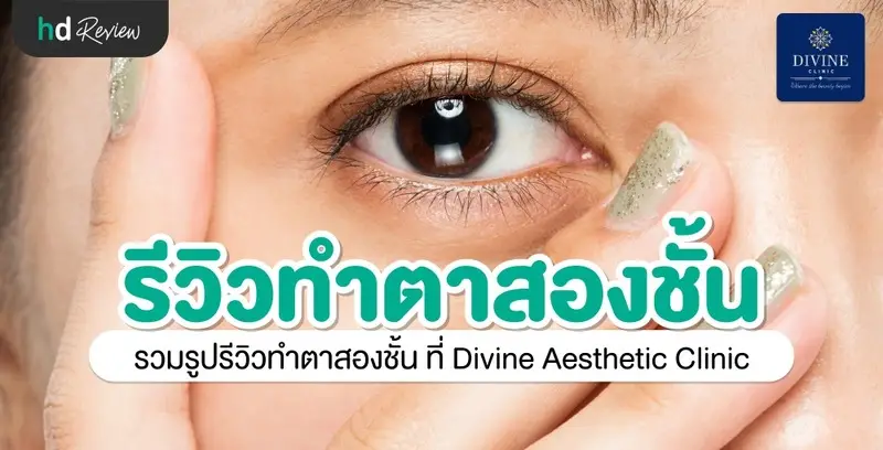 รีวิวทำตา 2 ชั้น ที่ Divine Aesthetic Clinic