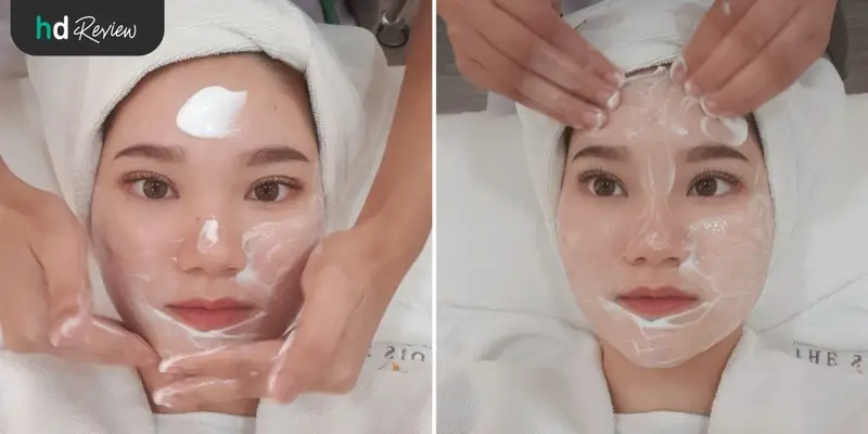 ขั้นตอนการเลเซอร์รักษารอยแผลเป็นจากสิวและหลุมสิวครั้งที่ 3 ที่ The Sign Clinic