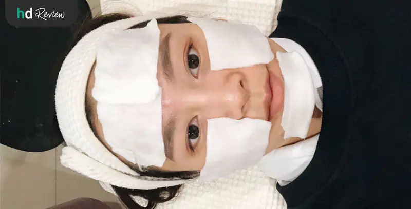ขั้นตอนการทำ Vbeam Laser เพื่อให้หน้าสดไร้รอยสิว ที่ Proderma Aesthetic Clinics