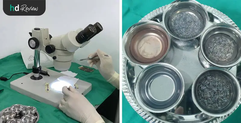 ขั้นตอนการปลูกผม ด้วยเทคนิค FUE ที่ GROW & Clinic วันที่ 2