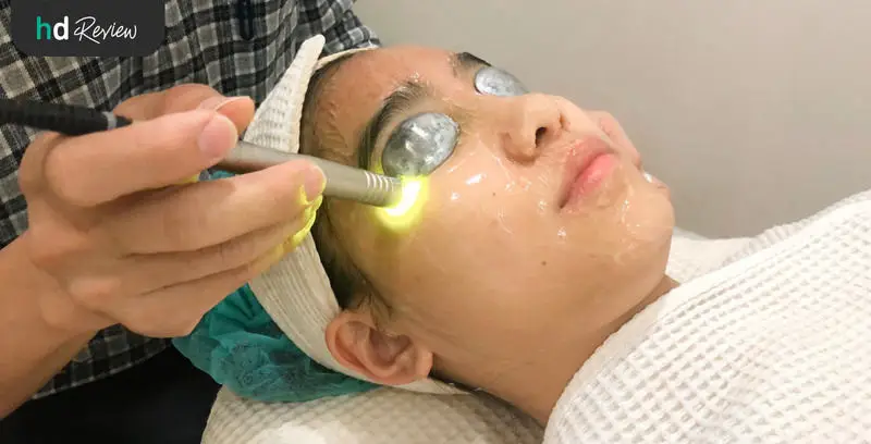 ขั้นตอนการทำ Dual Yellow Laser เพิ่มความกระจ่างใส ลดรอยสิว