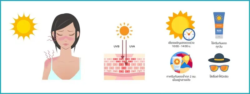 จุดด่างดำแห่งวัย (Age Spots)