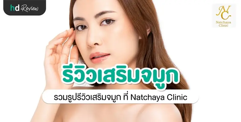 รีวิว เสริมจมูก ที่ Natchaya Clinic ณัฐชญา คลินิก