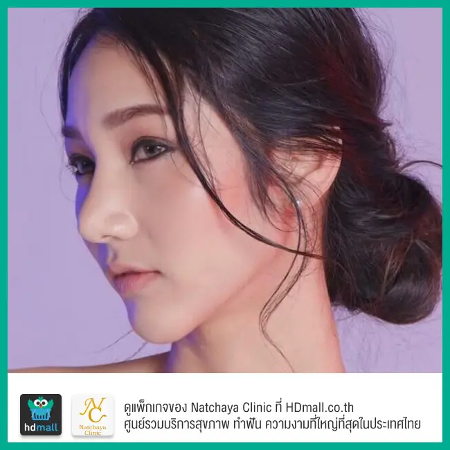 รีวิวศัลยกรรมจมูก ที่ Natchaya Clinic (ณัฐชญา คลินิก)