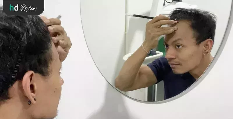 ขั้นตอนการปลูกผม ด้วยเทคนิค FUE ที่ GROW & GLOW Clinic