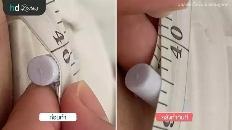 ภาพเปรียบเทียบก่อนทำและหลังทำ