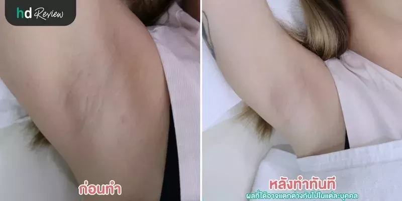 ผลลัพธ์หลังจากใช้บริการ