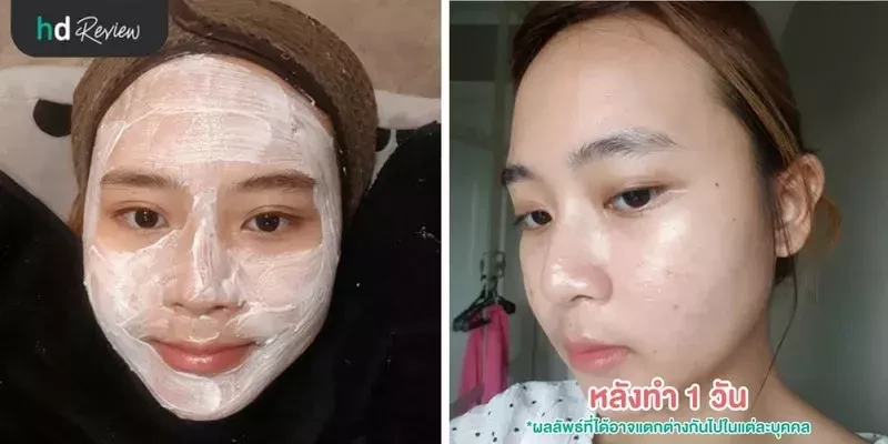 ผลลัพธ์หลังทำ 1 วัน