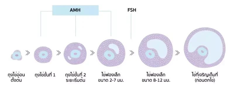ถุงน้ำรังไข่ โดย Yesmom