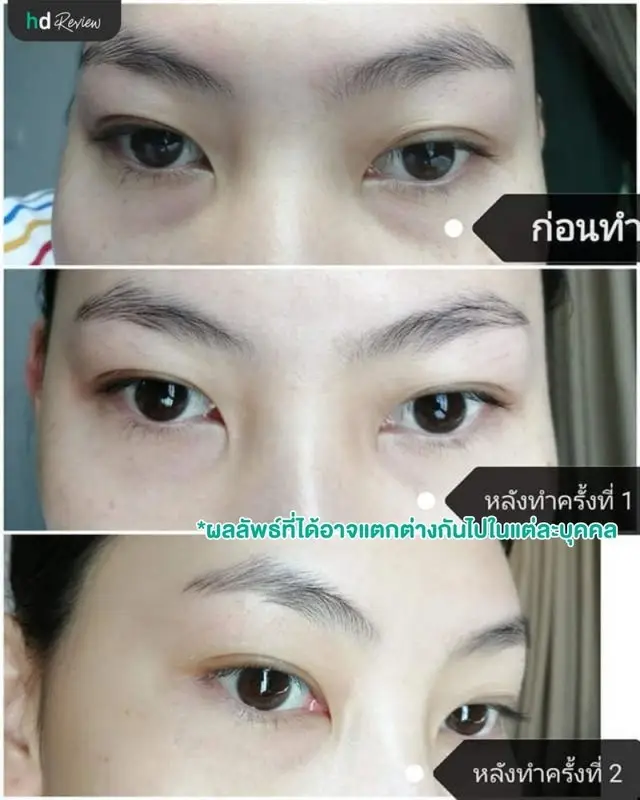 ภาพเปรียบเทียบก่อนทำกับหลังทำครั้งที่ 1 และครั้งที่ 2