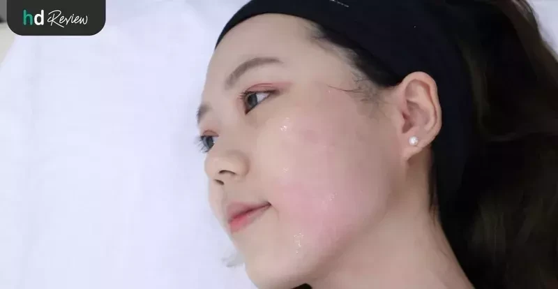 ขั้นการทำ Hifu Hi-Queen ยกกระชับ ทำหน้าเรียว ที่ La Grace Clinic