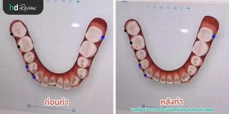 ภาพตัวอย่างก่อนทำและหลังทำ
