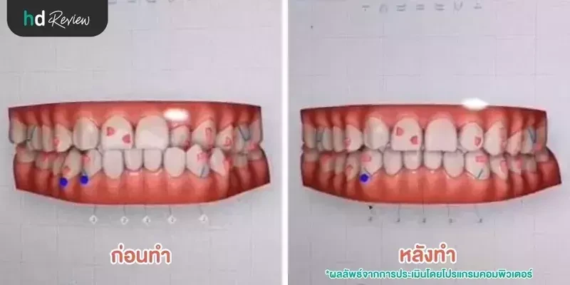 ภาพตัวอย่างก่อนทำและหลังทำ