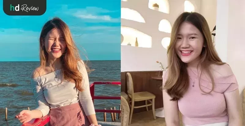 ผู้ใช้บริการทำรีเทนเนอร์ แบบลวด ที่ Zenitoni Dental Clinic