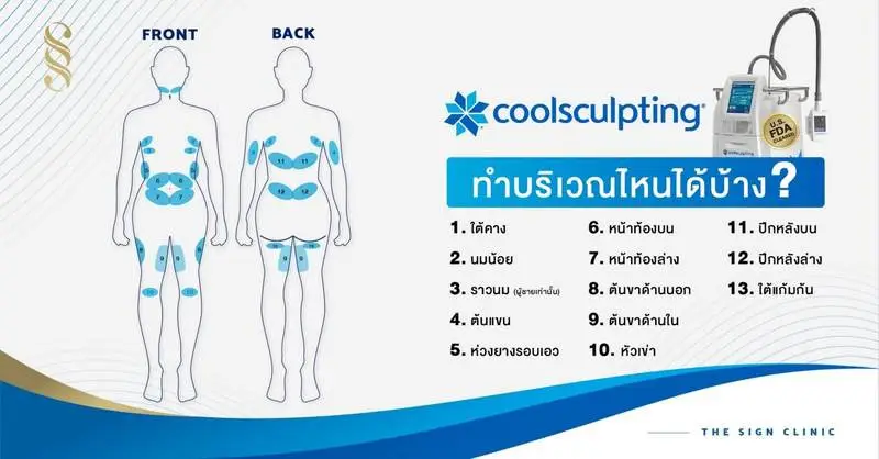 รีวิว CoolSculpting สลายไขมันถาวร ปรับหุ่นลดสัดส่วนโดยไม่ต้องผ่าตัด ที่เดอะไซน์ คลินิก (The Sign Clinic) 6 content coolsculpting 200602 0005