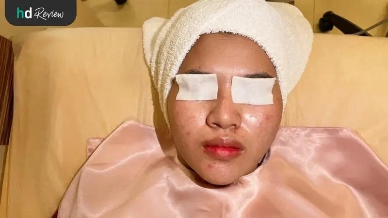 รีวิว Treatment รักษาสิว ที่ Clinic Khunmor เชียงใหม่ (คุณหมอบิ้วตี้แคร์)
