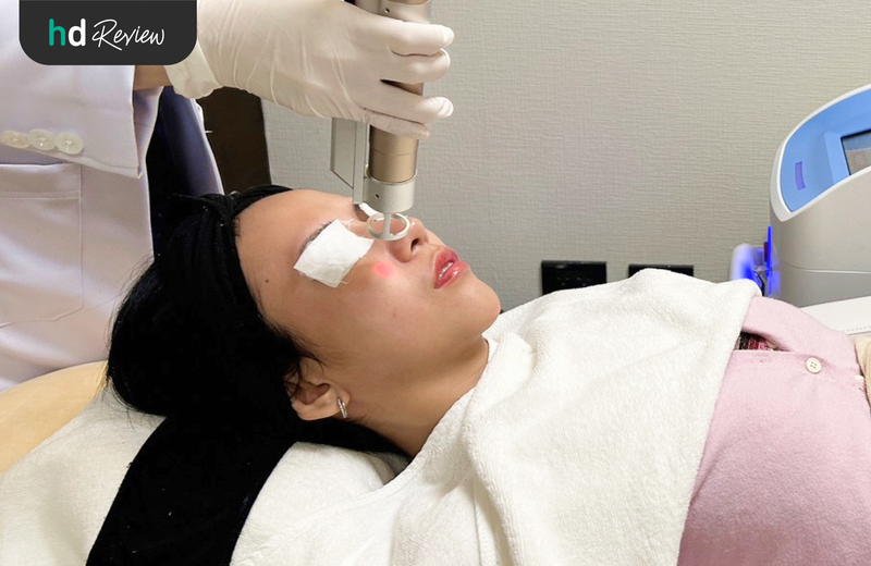 ขั้นตอนรักษาสิว ด้วย Yag Laser