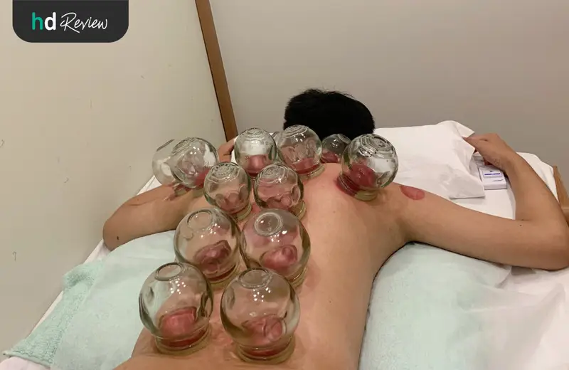 ภาพขั้นตอนการครอบแก้ว