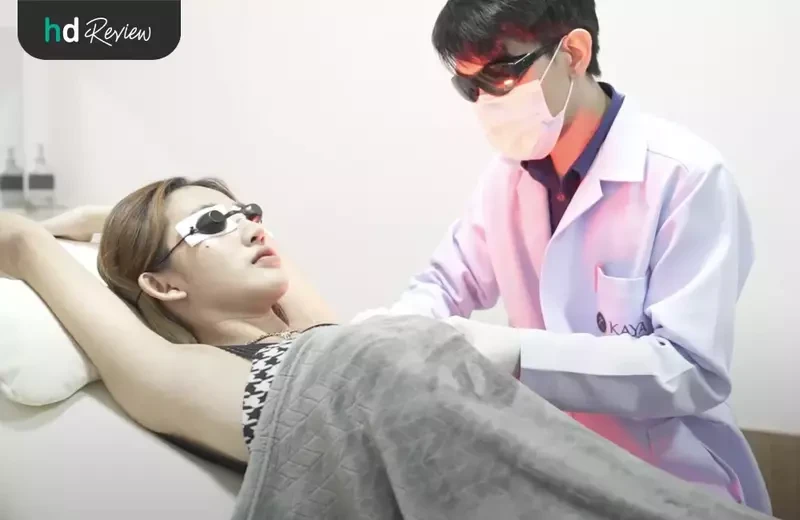 ัขั้นตอนการกำจัดขนรักแร้ด้วย IPL ที่ KAYA Alternative Polyclinic