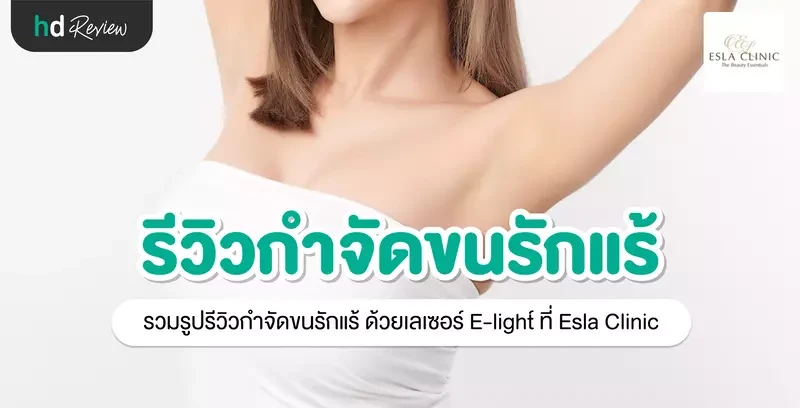 รีวิว กำจัดขนรักแร้ ด้วยเลเซอร์ E-light ที่ Esla Clinic