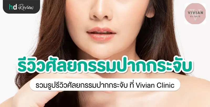 รีวิว ศัลยกรรมปากกระจับ ที่ Vivian Clinic