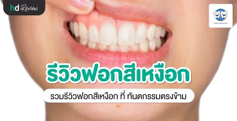 รีวิว ฟอกสีเหงือก ที่ ทันตกรรมตรงข้าม
