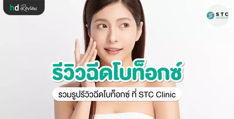 รีวิว ฉีดโบท็อกซ์ ที่ STC Clinic