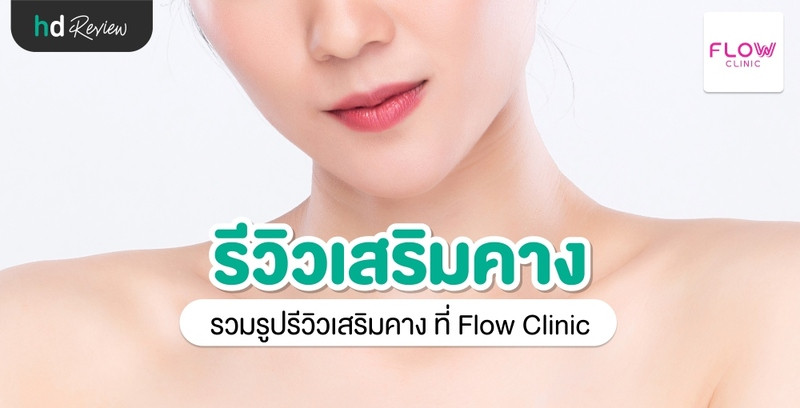 รีวิว เสริมคาง ที่ Flow Clinic