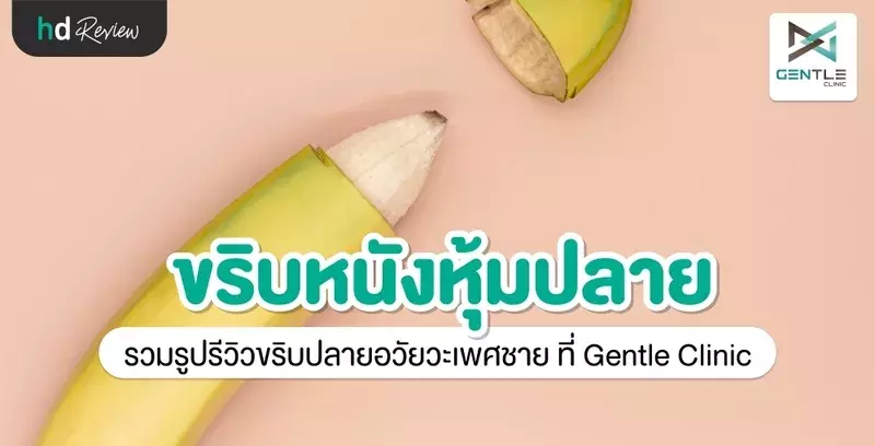 รีวิว ขริบหนังหุ้มปลายอวัยวะเพศชาย ที่ Gentle Clinic