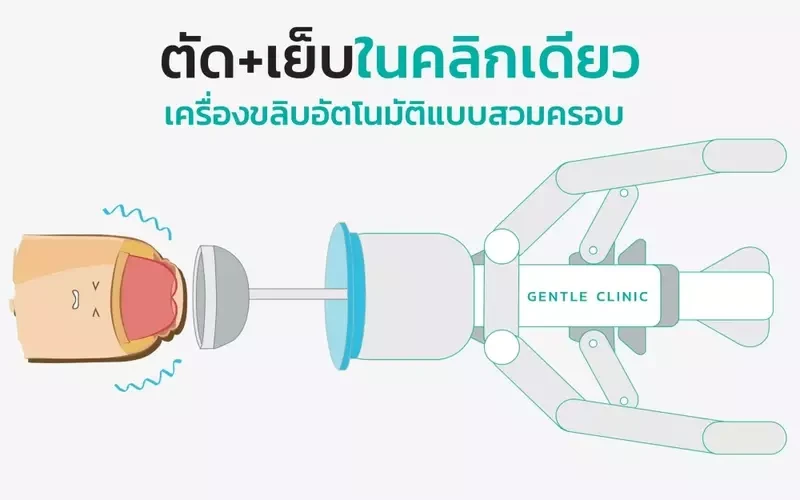 การขริบหนังหุ้มปลายอวัยวะเพศชาย ที่ Gentle Clinic