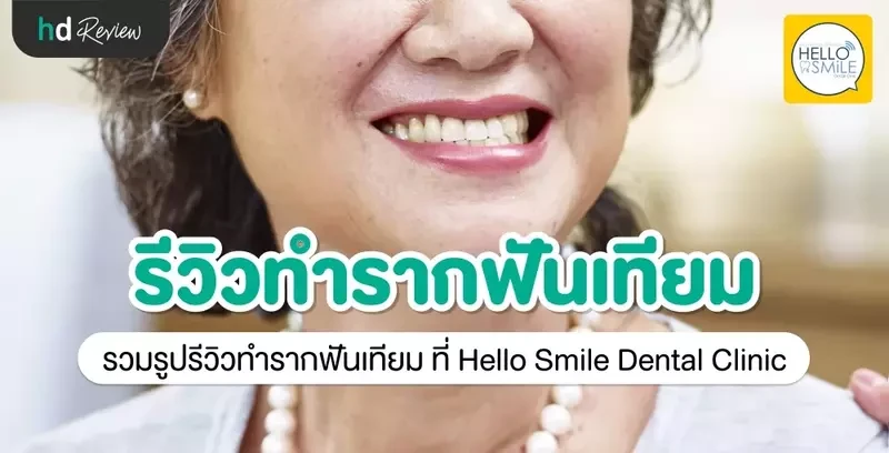 รีวิว ทำรากฟันเทียม ที่ Hello Smile Dental Clinic