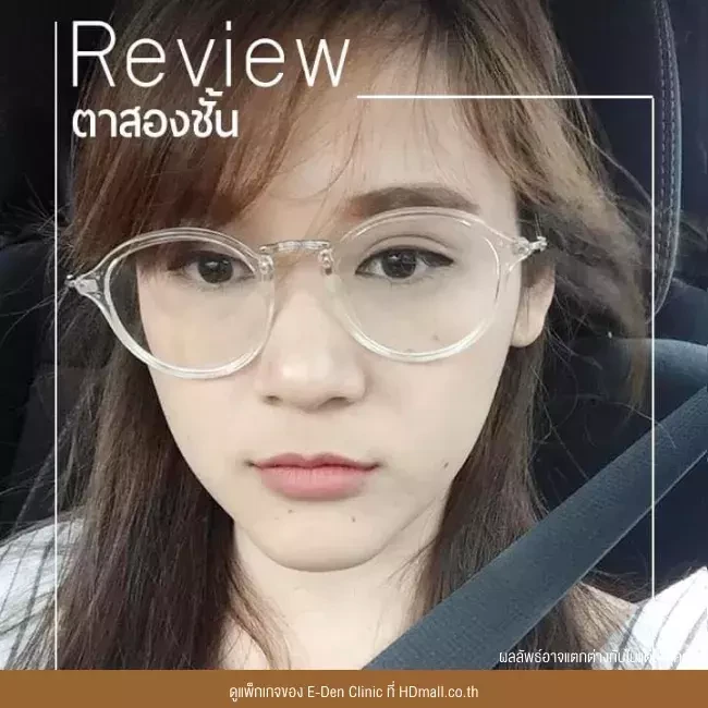 รีวิว ทำตาสองชั้น ที่ E-Den Clinic